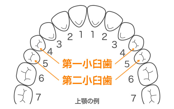 便宜抜歯の対象となる歯は第一小臼歯、第二小臼歯