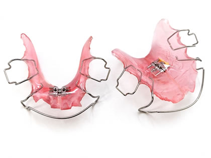 子どもの矯正治療で行われる歯列拡大治療