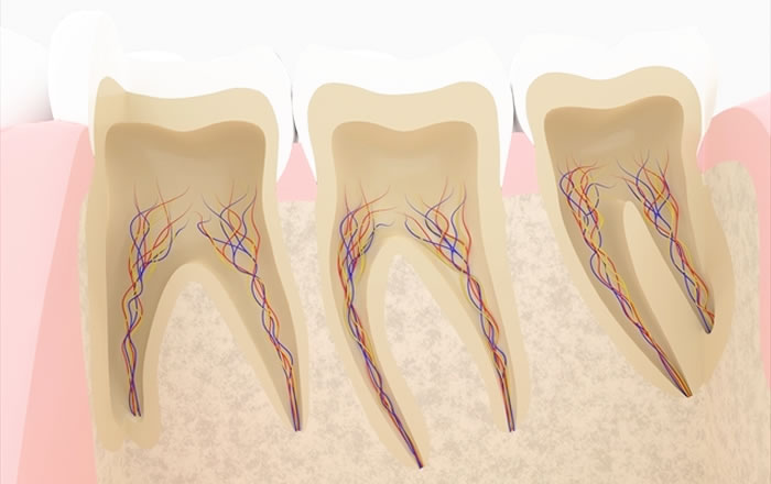 根管の形状が複雑