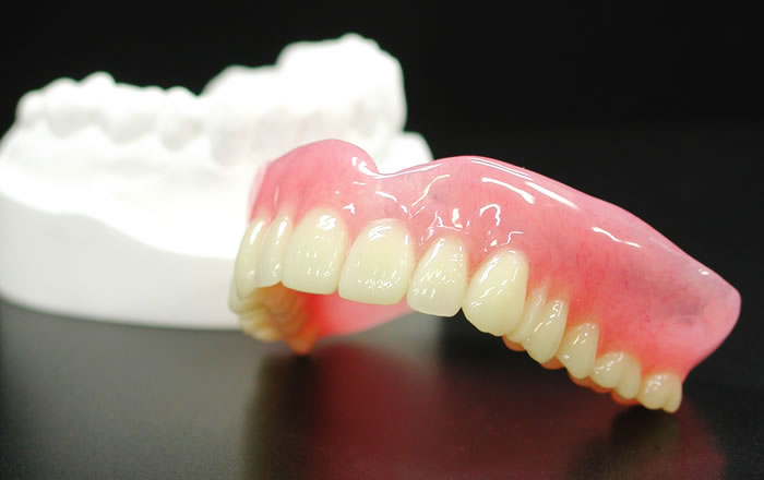 インプラント義歯をおすすめする方：入れ歯の大きさを少しでも小さくしたい方、入れ歯で噛めない方