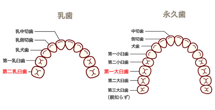 乳歯の歯肉炎