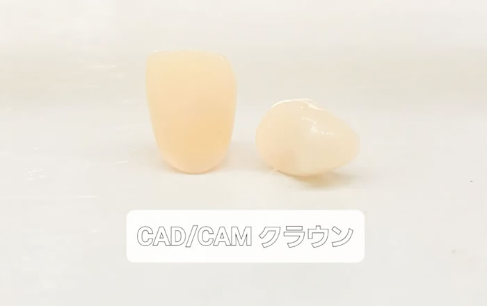 CAM／CAD冠