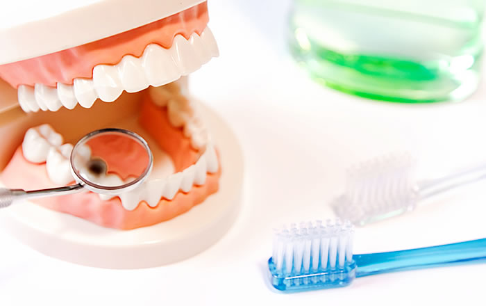 虫歯や歯周病の予防