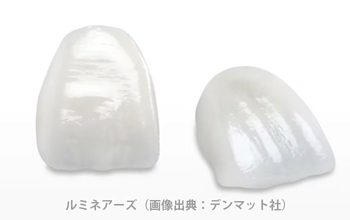 ルミネアーズとは
