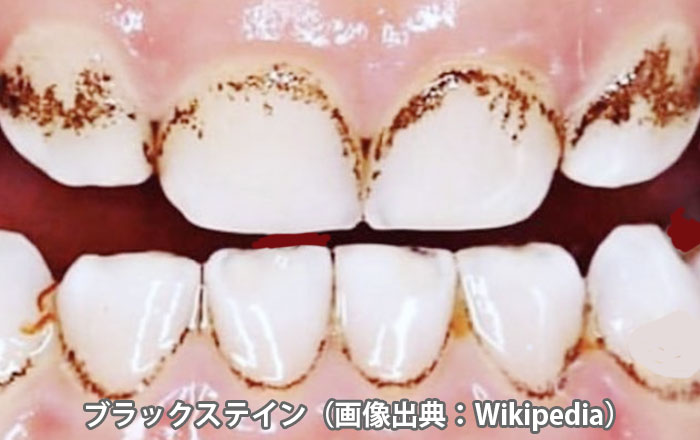 ブラックステインについて