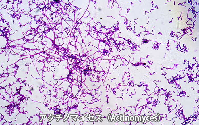 ブラックステインの原因となるActinomyces(アクチノマイセス)