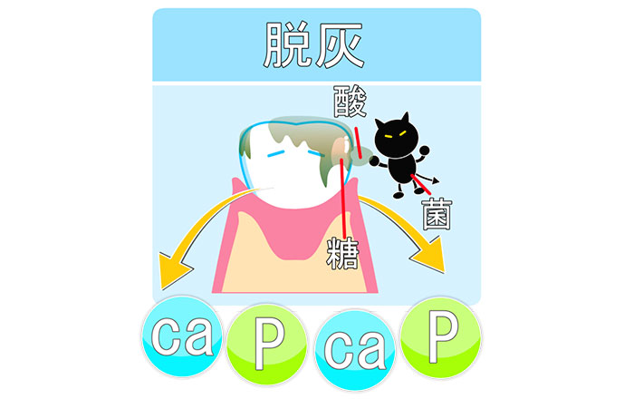 脱灰(だっかい)