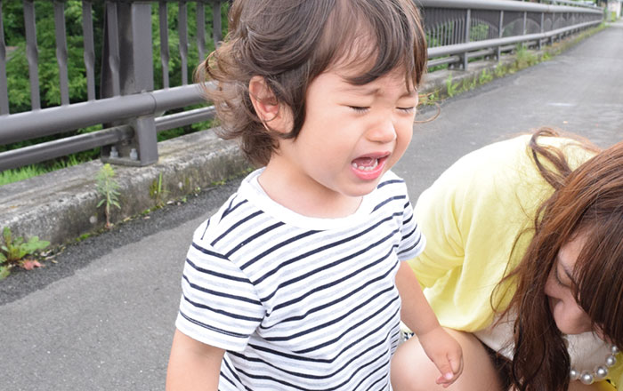 乳歯が抜けない理由:外傷による影響