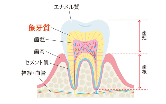 覆髄材の効果：外部からの刺激を遮断する