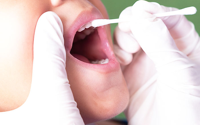 歯科医院で使われるフッ素は高濃度(9000ppm)ですが、歯科医師・歯科衛生士が厳密に量を管理して塗布します。