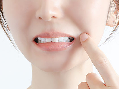 ホワイトニングで「しみる」原因と対処法