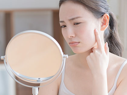 歯周病菌と肌荒れ(ニキビ・湿疹)の意外な関係