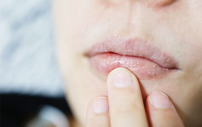 歯科・皮膚科に相談すべきタイミング