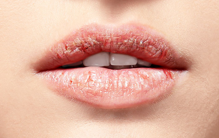 気になる唇の乾燥…ついつい舌で舐めていませんか?