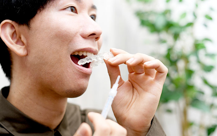 親になってから見直したい歯とお口の予防ケア:親自身も治療やホワイトニングを行って子どものお手本になる