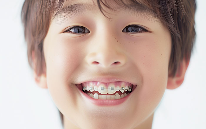 子どもの矯正治療は、大人の矯正とは異なります。成長期に矯正治療を行うと、顎の成長を利用することで、将来の抜歯を伴う矯正を回避できる可能性が高くもなります。