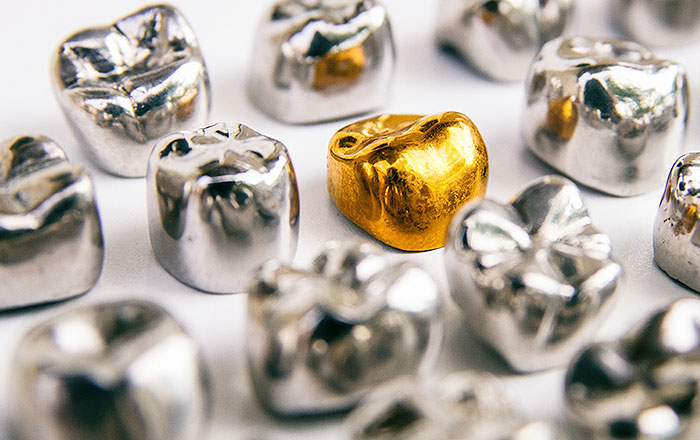 ガルバニー電流が発生しやすい組み合わせ:銀歯と金歯