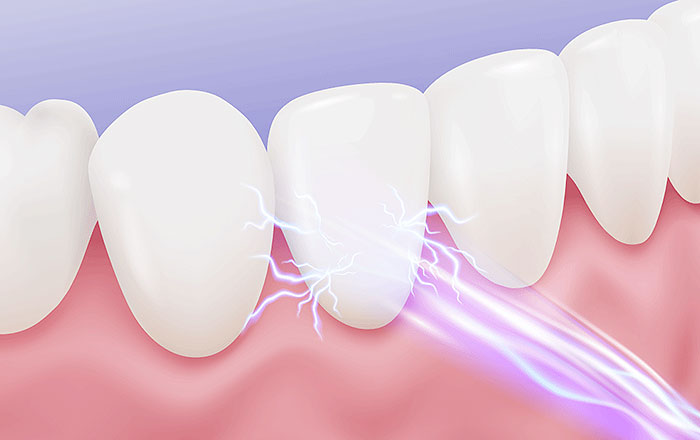 お口の中でピリッとした痛みが走る?ガルバニー電流とは?