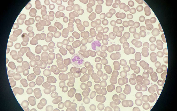 時間帯によって痛みに波がある理由:免疫力の差