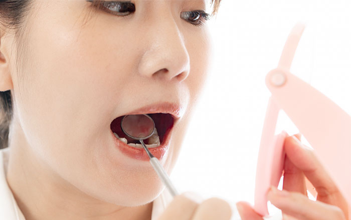 化学熱傷の特性:熱傷の深さが分かりにくい