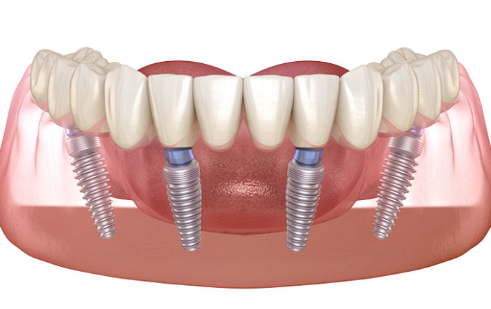 プロアーチがおすすめな人とは？