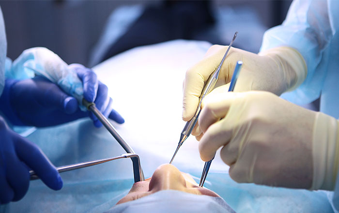 プロアーチのデメリット