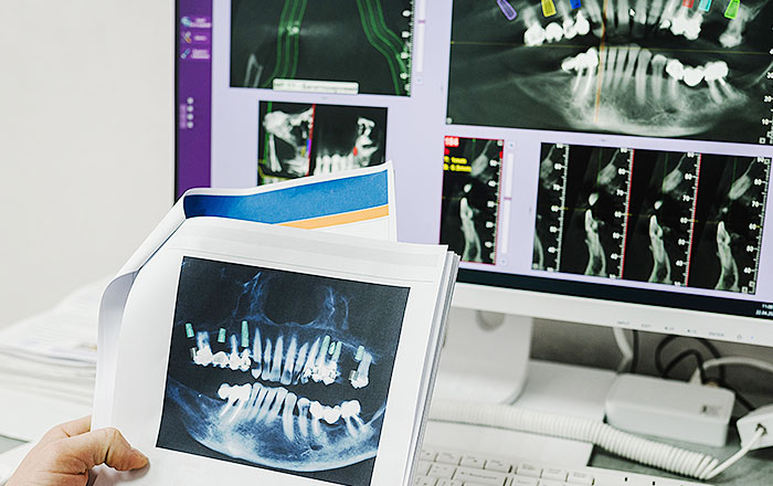 プロアーチの手術の流れ：治療計画の立案