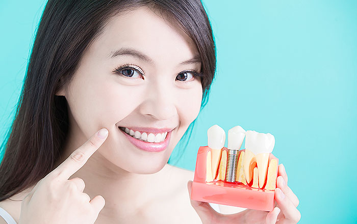 患者さん一人ひとりにぴったりのインプラント治療を