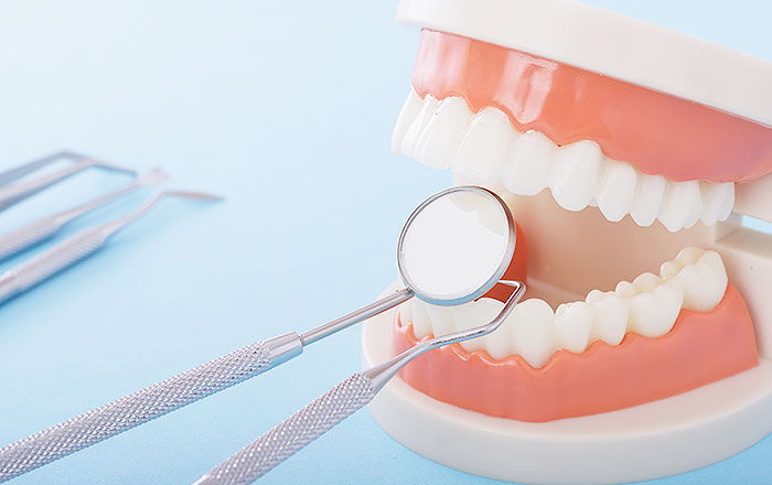 インプラント治療の流れ：4.初期治療