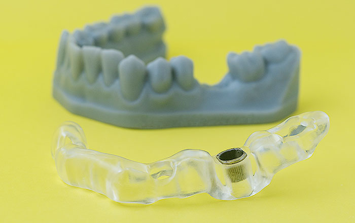 サージカルガイドの注意点