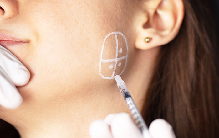 歯ぎしり・食いしばりの治療で用いられるボツリヌス注射とは？