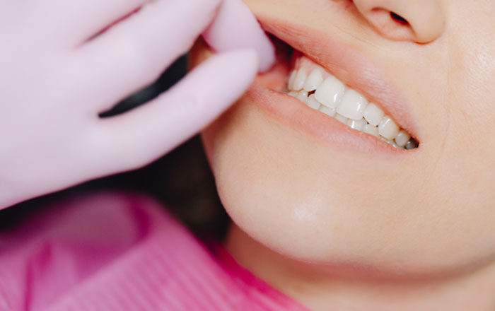 歯ぎしりは自覚がなくても要注意?セルフチェック法や歯ぎしりの原因と対策を解説