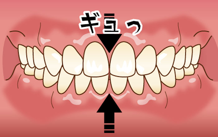 クレンチング(歯をグッと食いしばる)