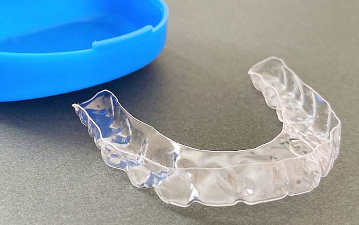 歯科医院でできる歯ぎしりの治療法:スプリント療法(ナイトガード)