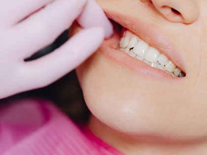 歯ぎしりは自覚がなくても要注意？セルフチェック法や歯ぎしりの原因と対策を解説