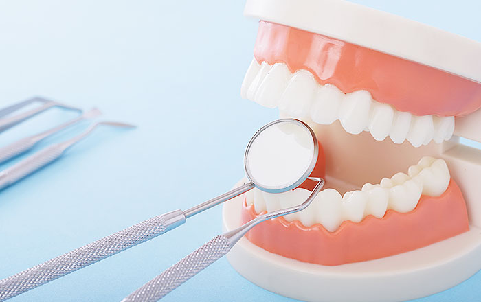 フォースデンティンのメリット：虫歯菌が増えにくくなる