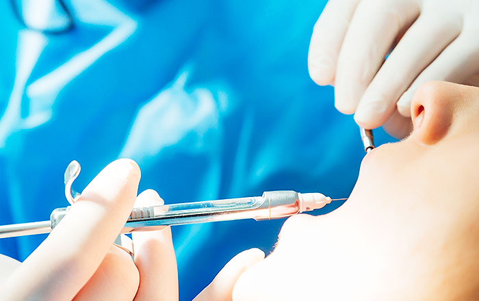 Q. 刺入時の痛みを抑えるには？