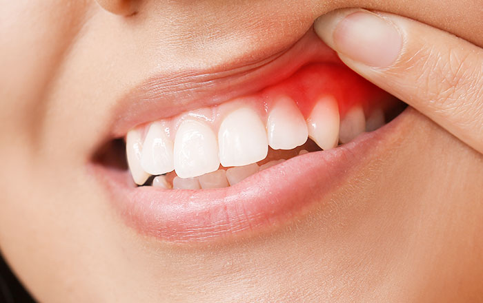 Q. 麻酔が効きにくいのはなぜ？