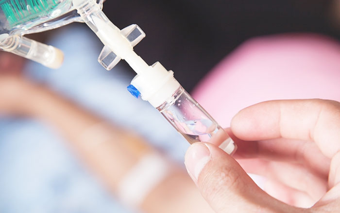 静脈内鎮静法（セデーション、IVS：Intravenous Sedation）